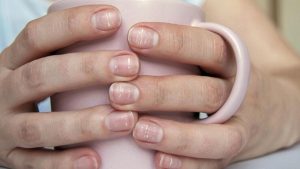 Пятна на ногтях: 10 признаков, которые сигналят о болезнях