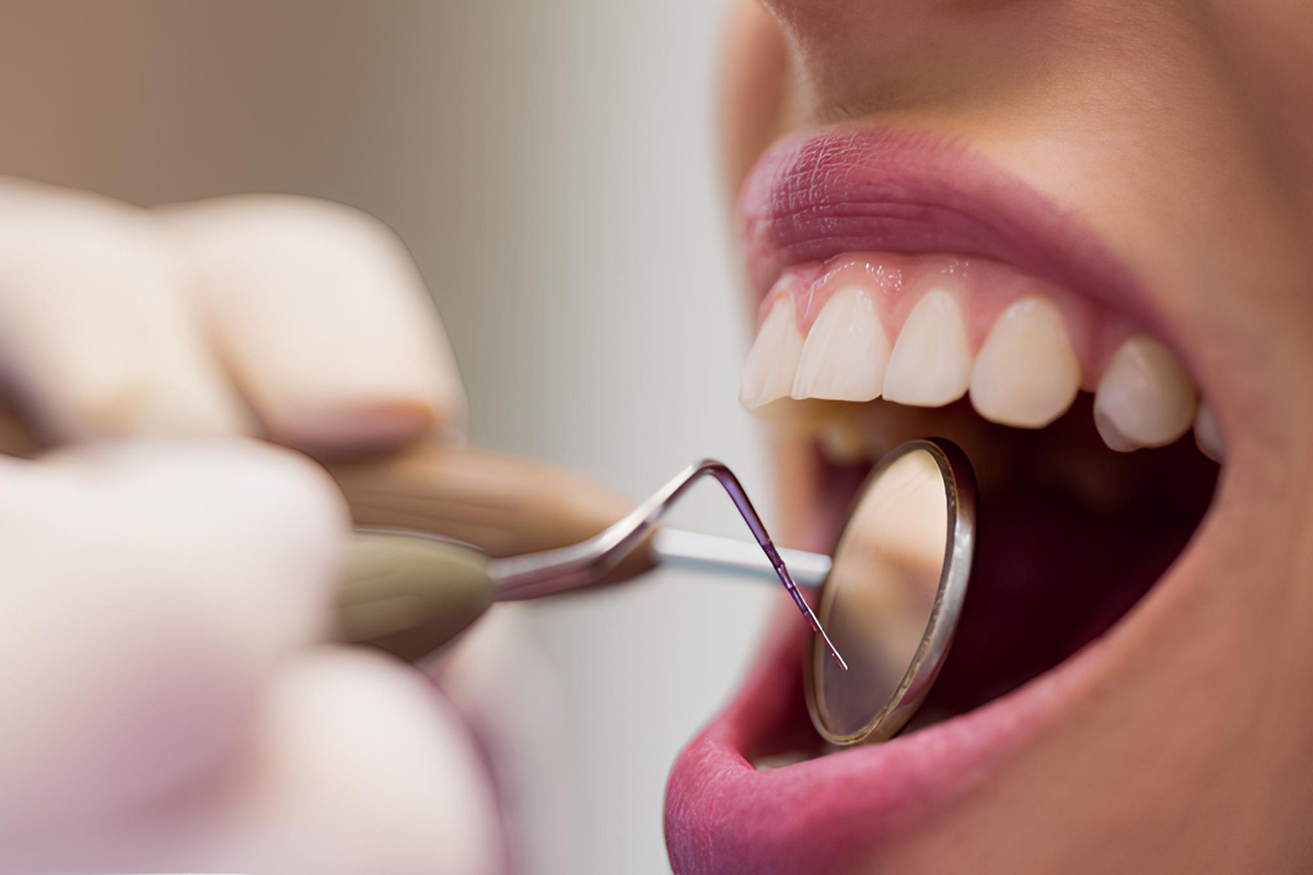 Почему зубы желтеют, даже если чистить идеально? 5 главных причин
