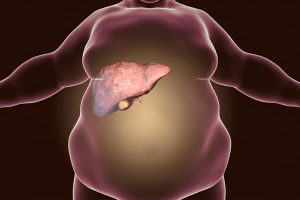 Почему от печени зависит образование жира?